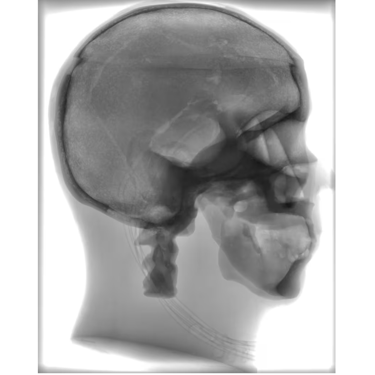 Adult Skull for X-Ray CT, US, MRI SL-A01 Image 7