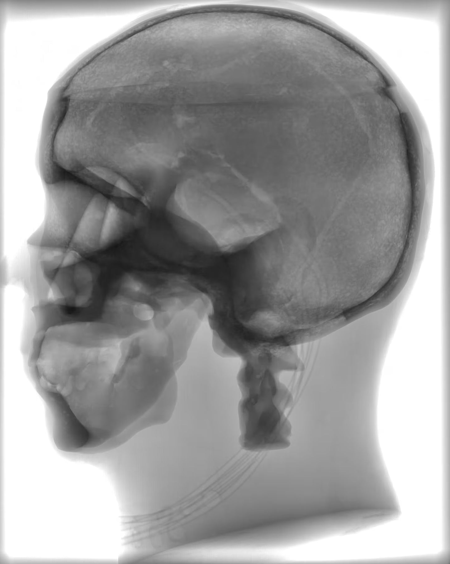 Adult Head (Standard) for X-Ray CT, US, MRI HD-A03 image 14