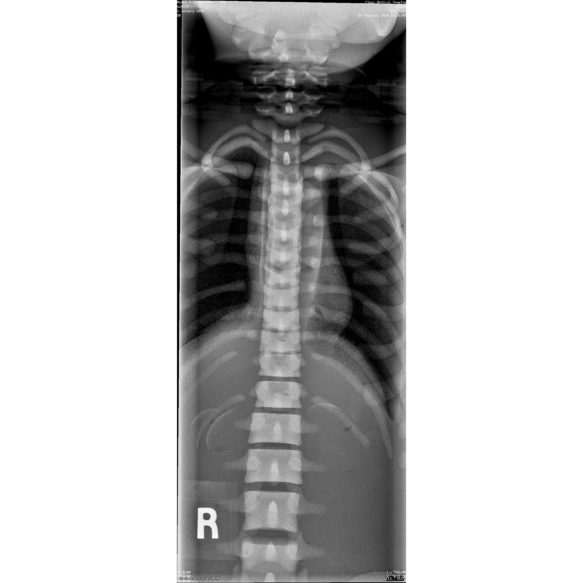 Paediatric Full Body for X-Ray CT, MRI FB-P01 image 23