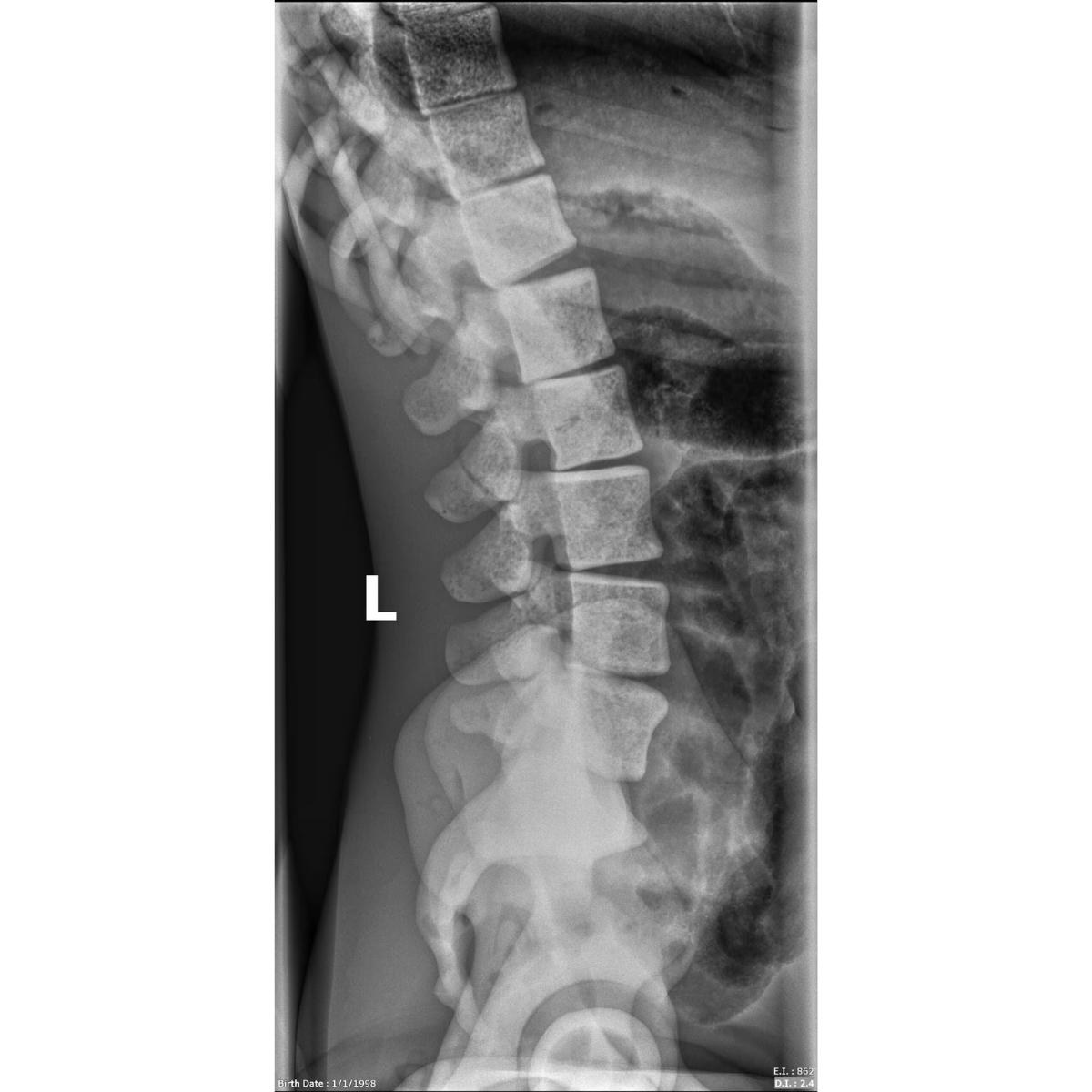 Adult Full Body with Muscles for X-Ray CT, MRI FB-A02 image 24