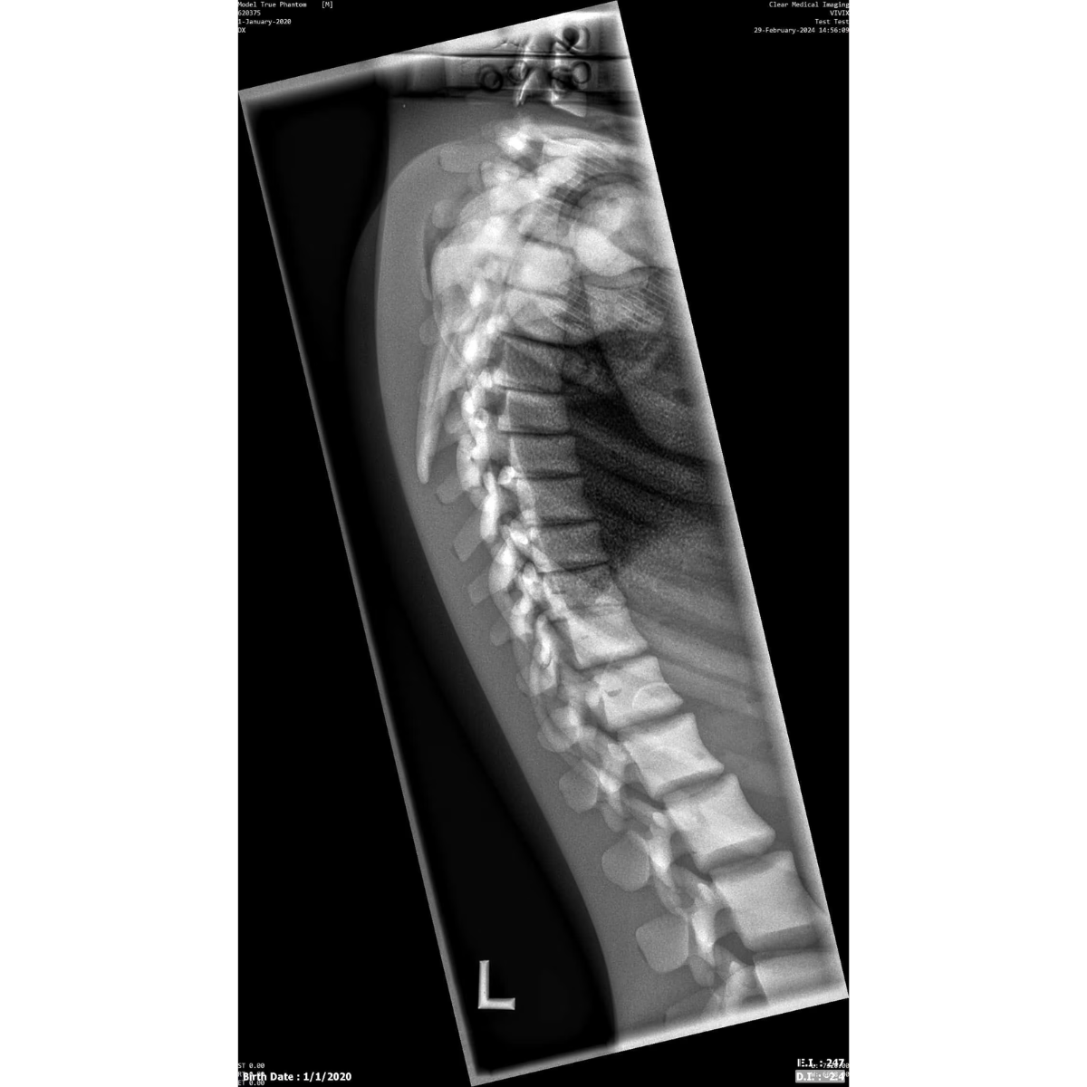 Paediatric Full Body for X-Ray CT, MRI FB-P01 image 24