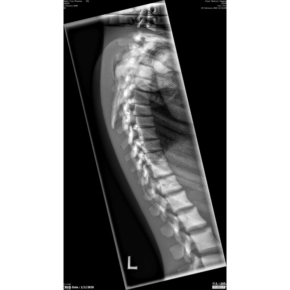 Paediatric Full Body Phantom for X-Ray CT, MRI