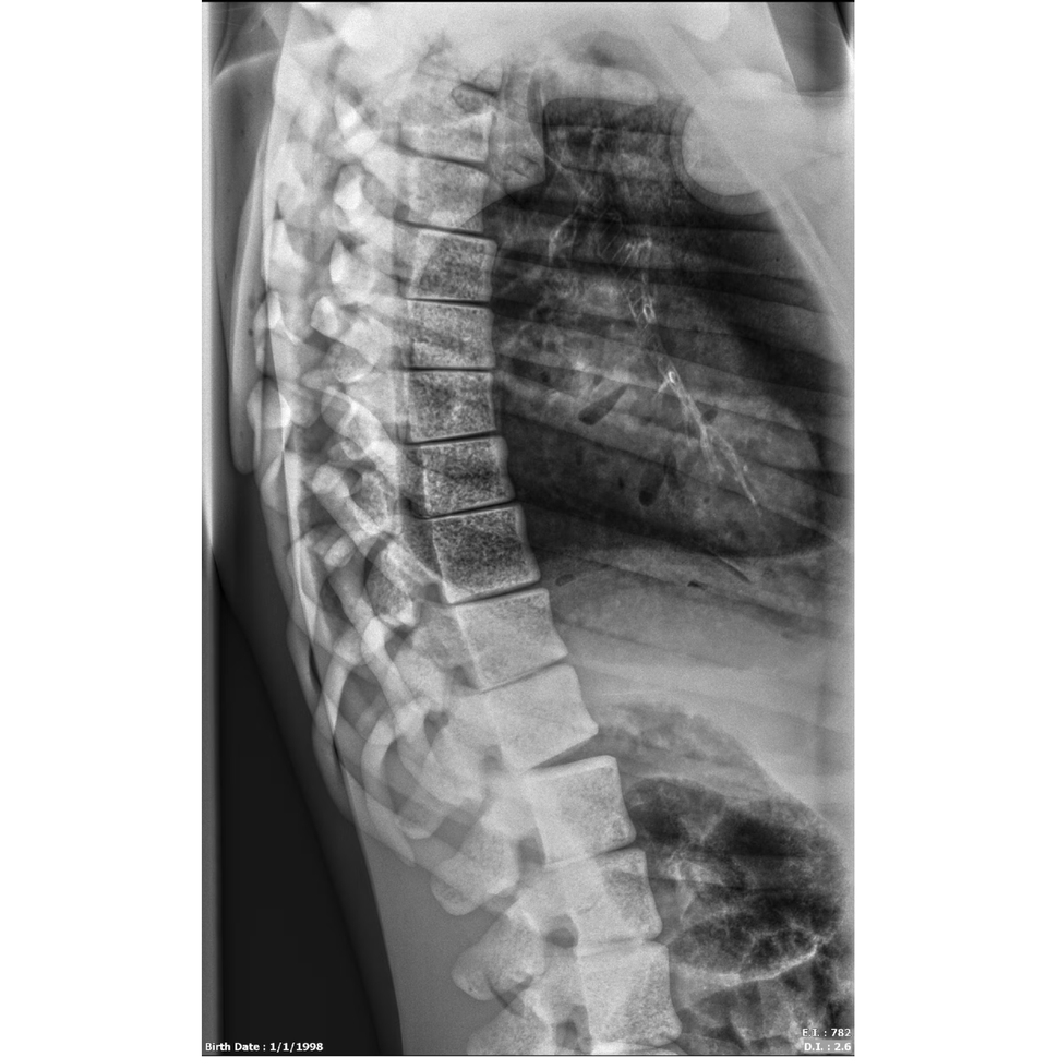 Adult Full Body Phantom with Muscles for X-Ray CT, MRI