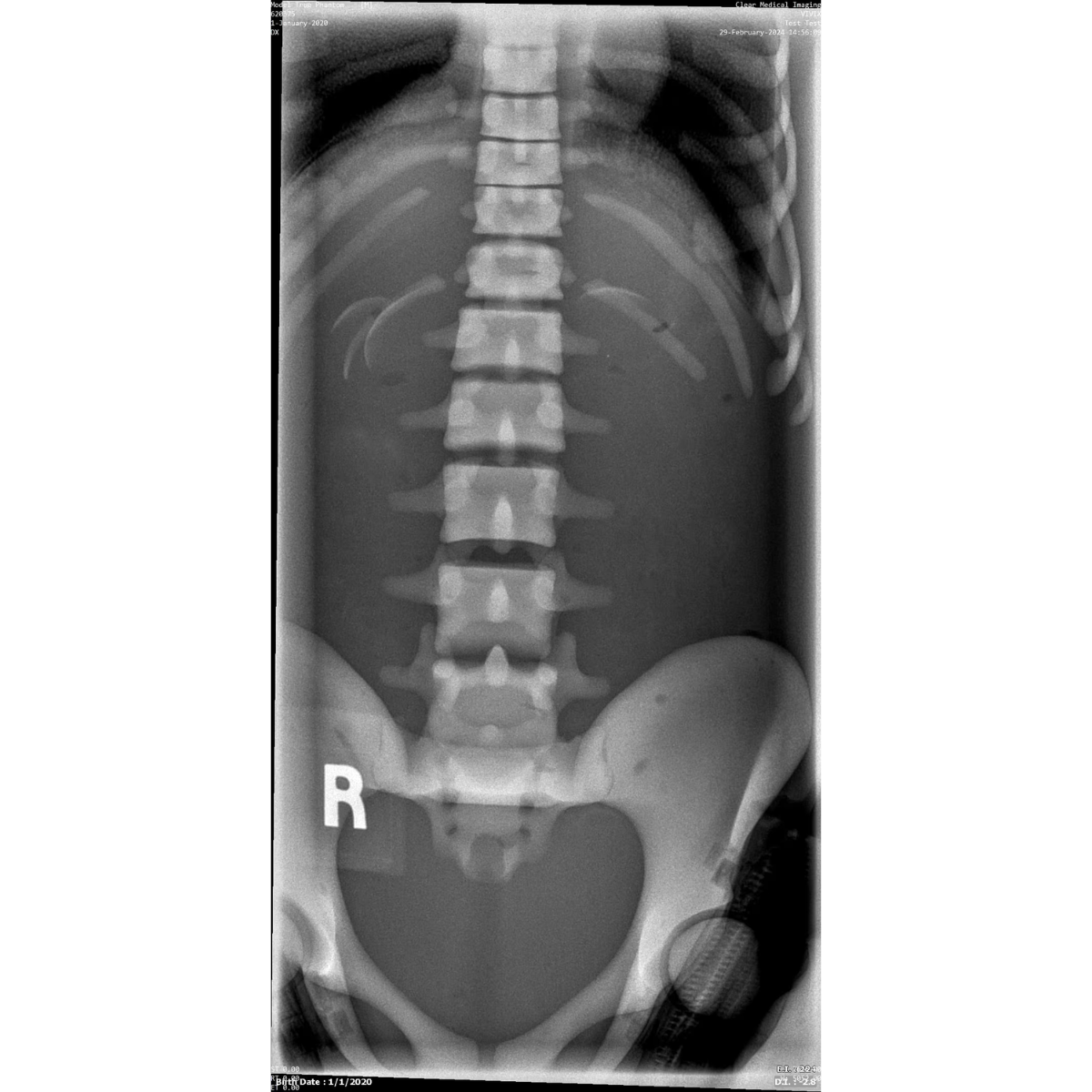 Paediatric Full Body Phantom for X-Ray CT, MRI