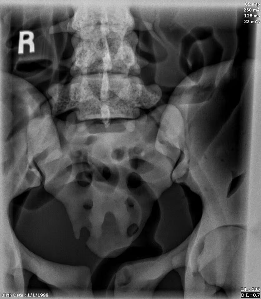 Adult Female Torso Phantom for X-Ray CT, MRI