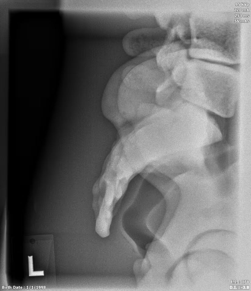 Adult Female Torso for X-Ray CT, MRI CT-A02 image 17
