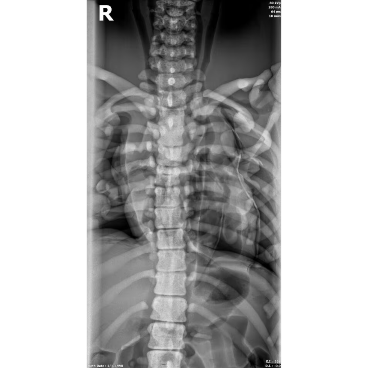 Adult Female Torso Phantom for X-Ray CT, MRI