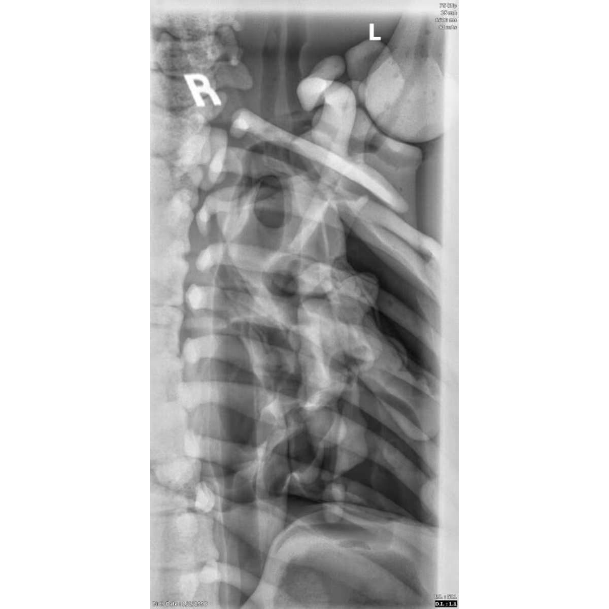 Adult Female Torso Phantom for X-Ray CT, MRI