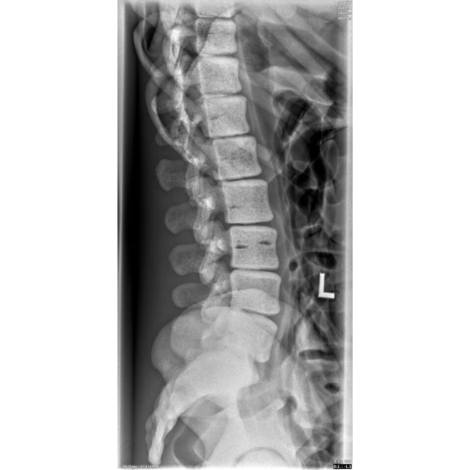 Adult Female Torso Phantom for X-Ray CT, MRI