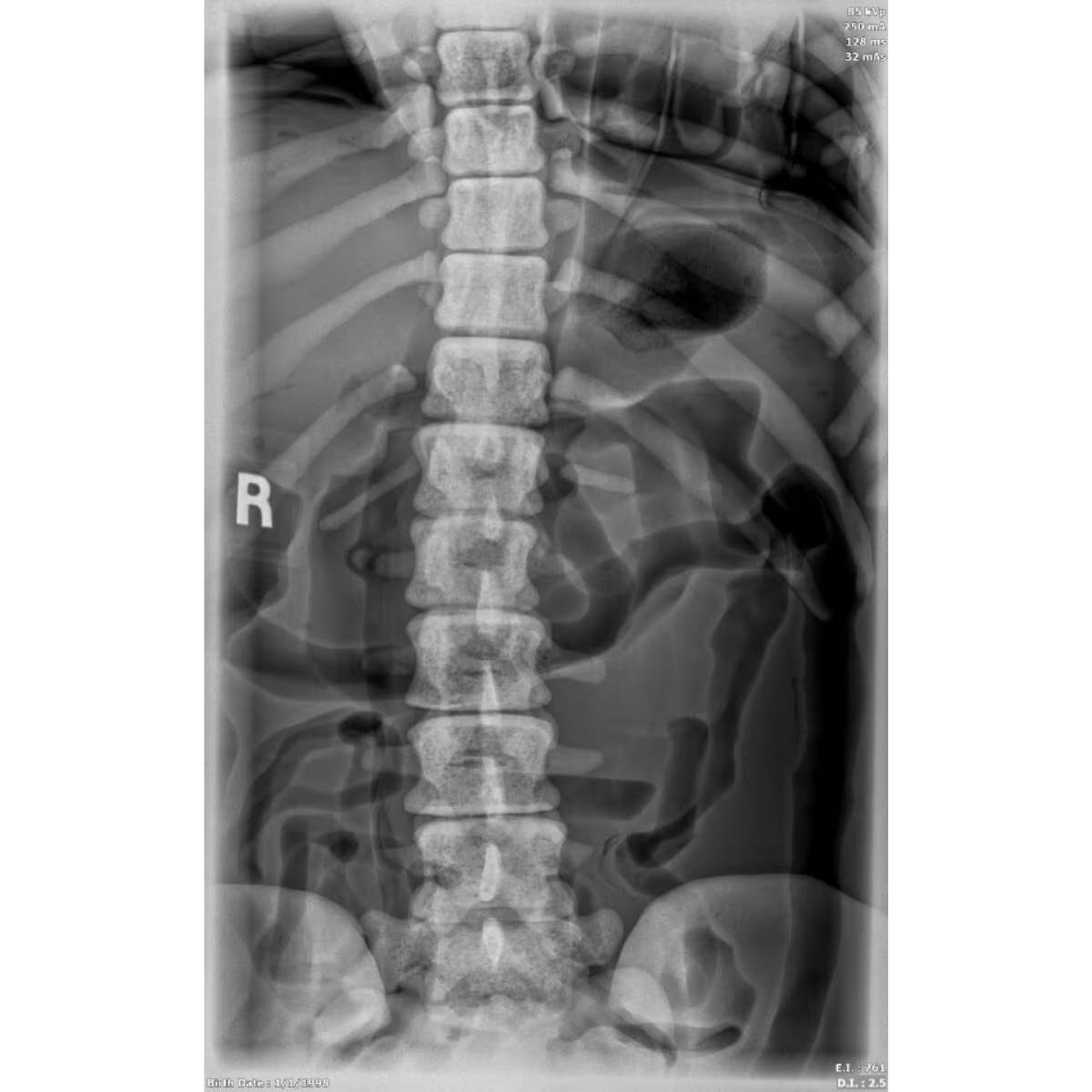 Adult Female Torso Phantom for X-Ray CT, MRI