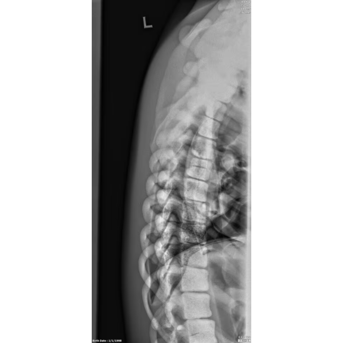Adult Female Torso Phantom for X-Ray CT, MRI