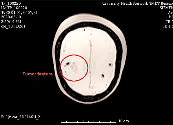 Adult Head Phantom (Standard) for X-Ray CT, US, MRI