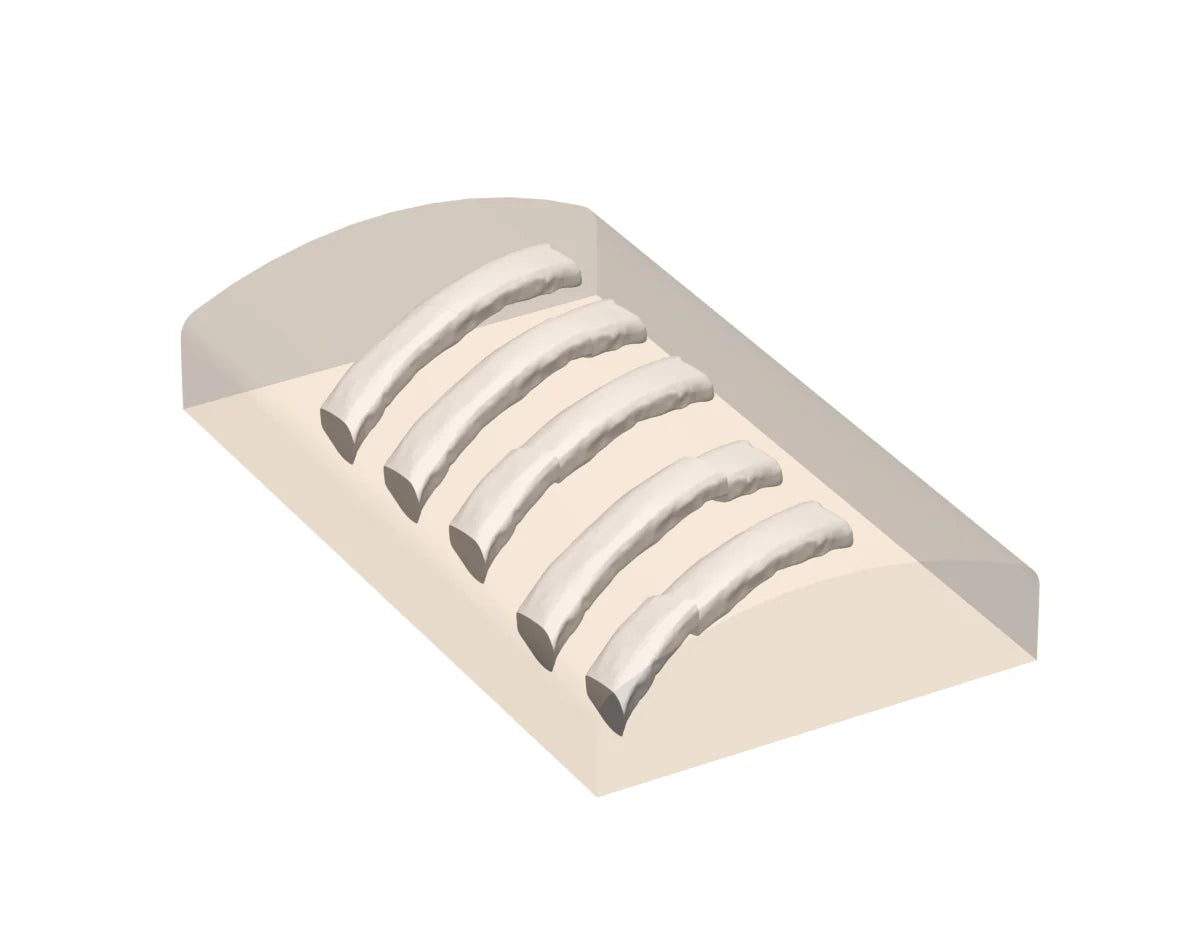 Ultrasound Phantom Bone Fracture