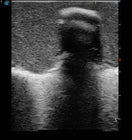Switch Ultrasound Images Of The Spine 3 image
