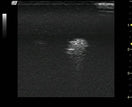 Switch Ultrasound Interpretation 3 image