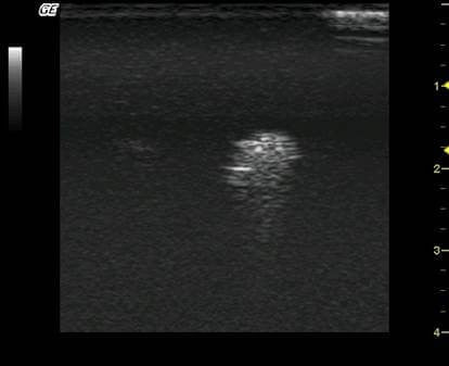 Ultrasound Interpretation