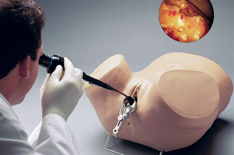 Hysteroscopy Simulator