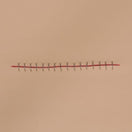 Switch Wound Care Training For Stapled Incision 2 image