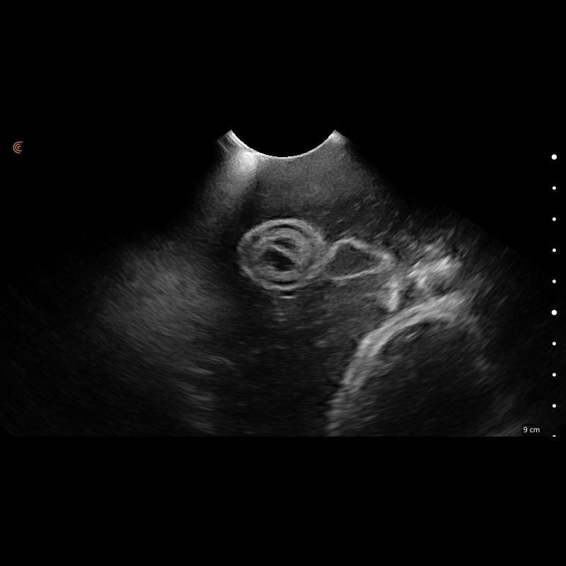 Lillie Canine Ultrasound Phantom Training Kit VET4850 Image 15