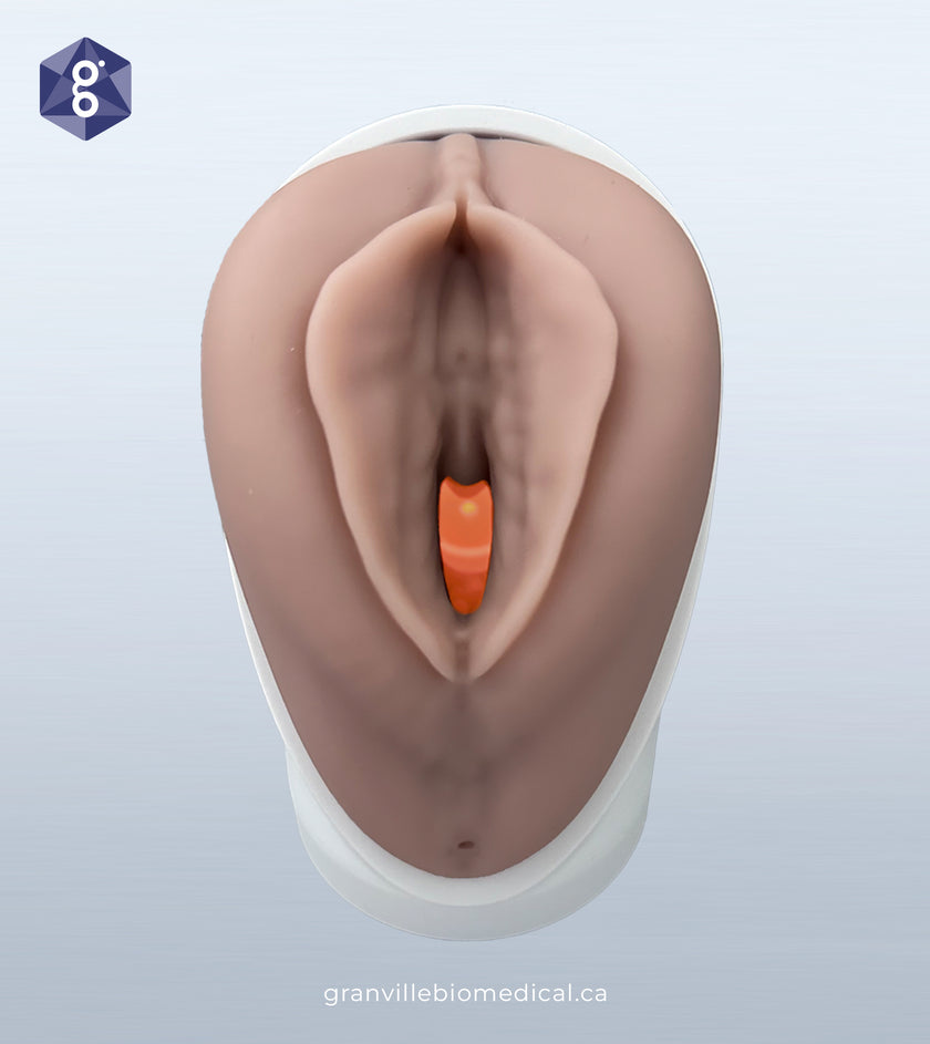 Venus Pelvic Health Model