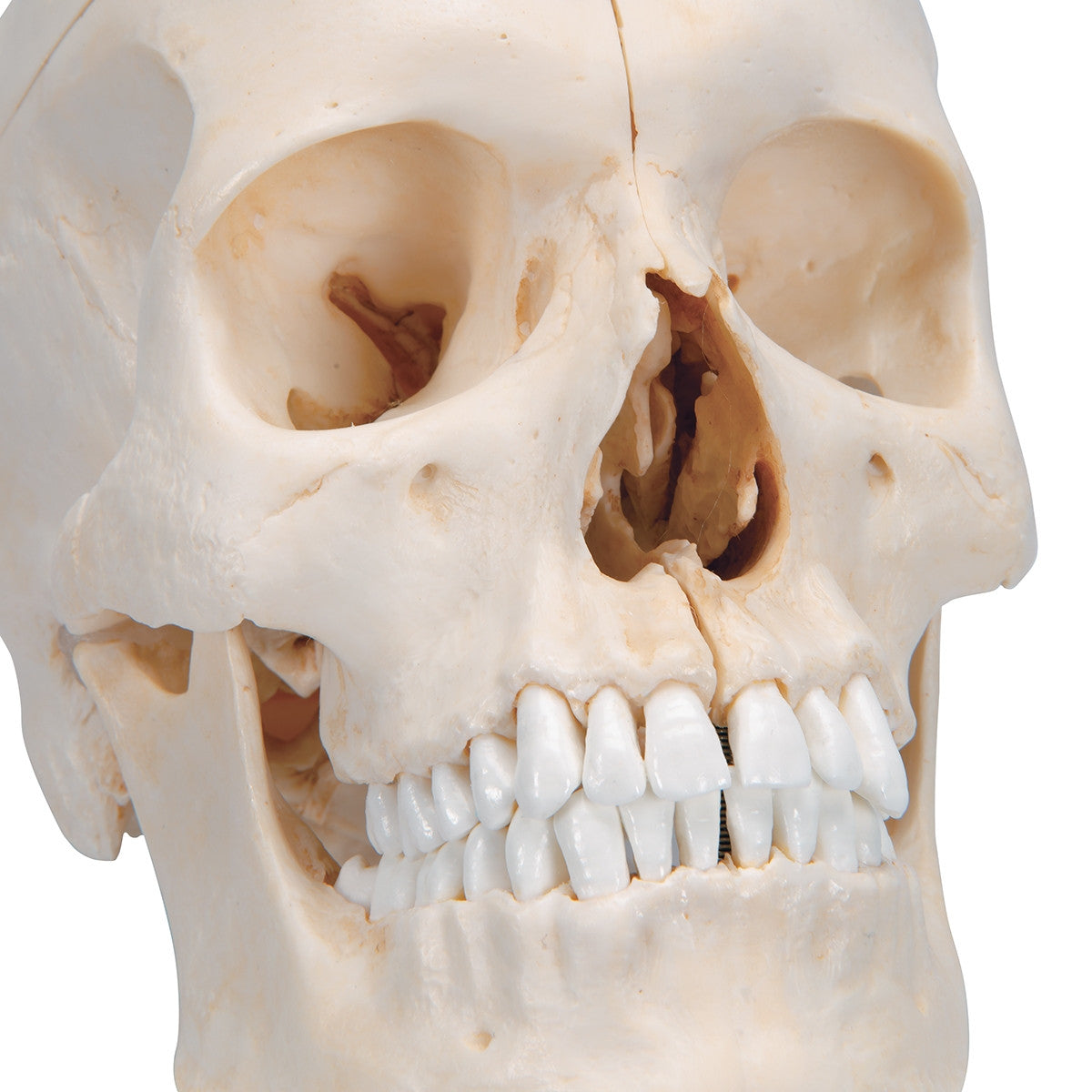 BONElike Skull Model (6 part)