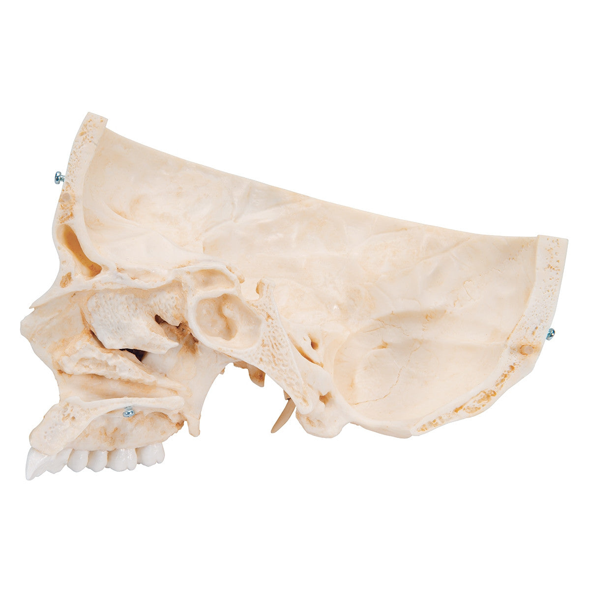 BONElike Skull Model (6 part)