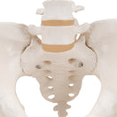 Switch the hip bone, sacrum with coccyx, and two lumbar vertebrae 3 image