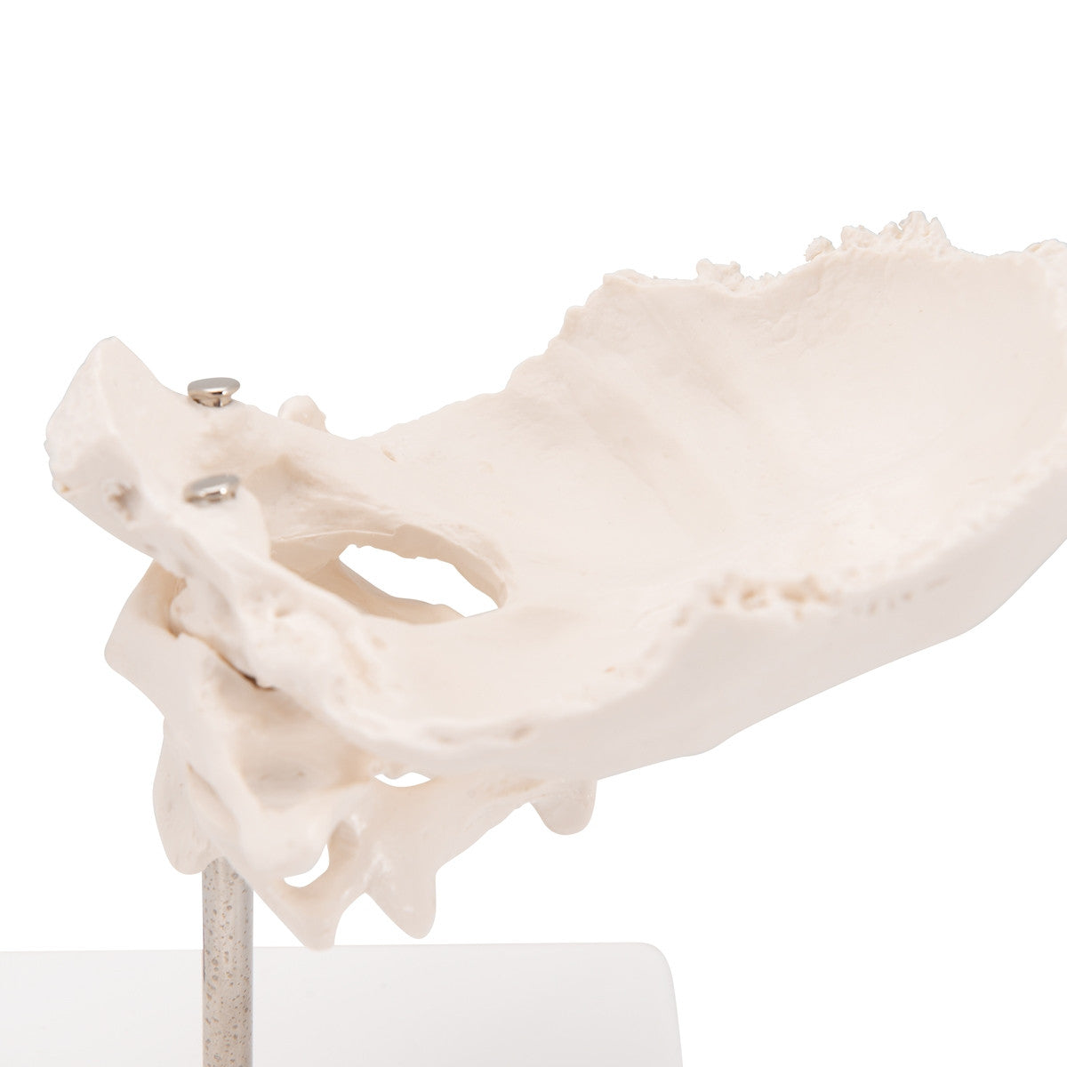 Atlas and Axis Model with Occipital Plate