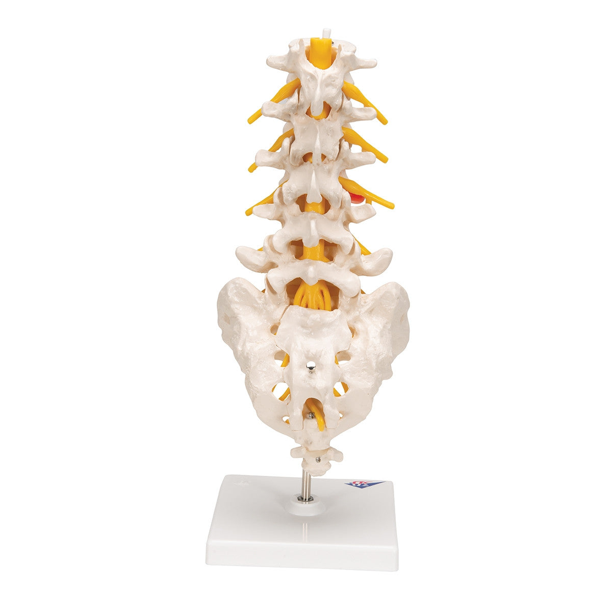 Lumbar Spine Model With Herniated Disc