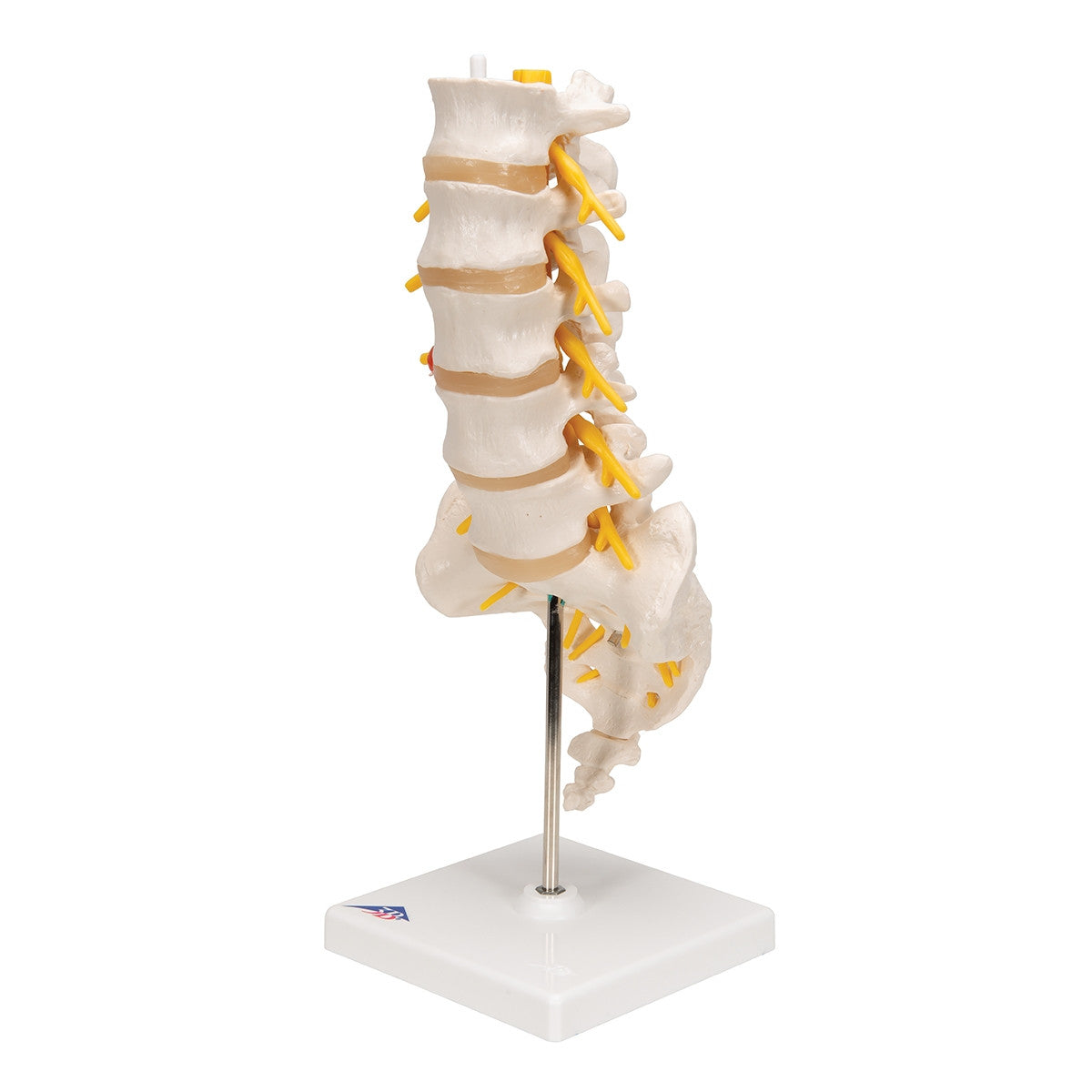 Lumbar Spine Model With Herniated Disc