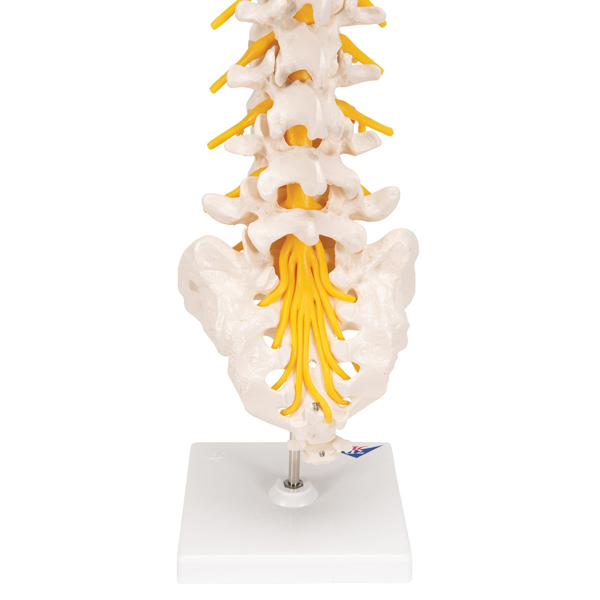 Lumbar Spine Model With Herniated Disc