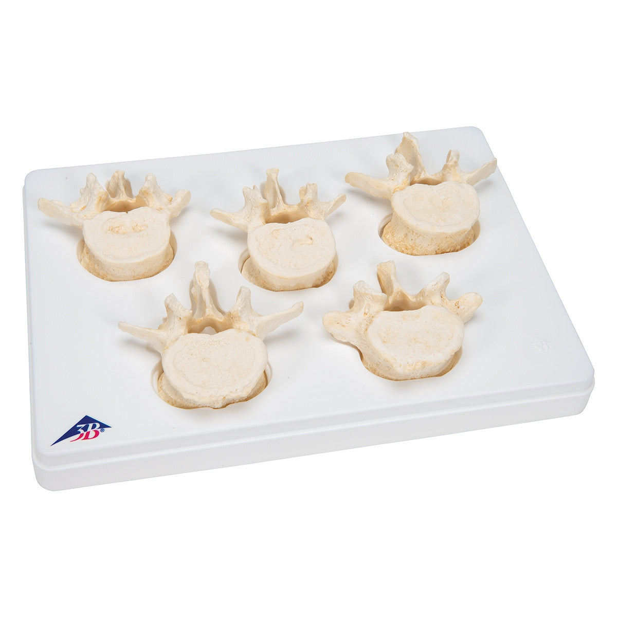 BONElike Lumbar Vertebrae Model Set (5 part)