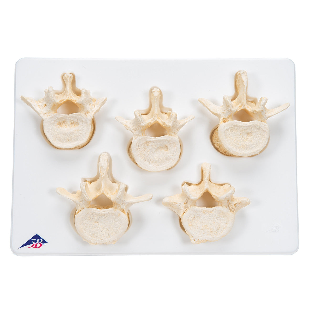 BONElike Lumbar Vertebrae Model Set (5 part)