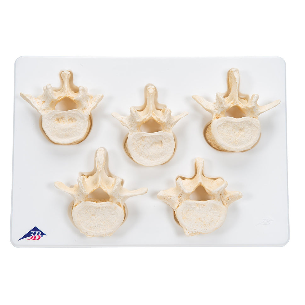 BONElike Lumbar Vertebrae Model Set (5 part)