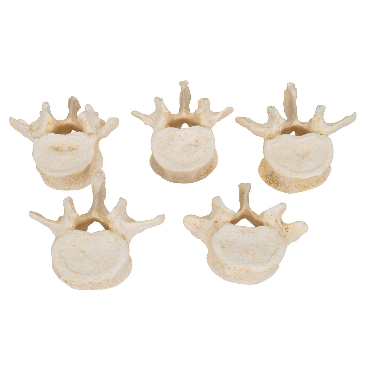 BONElike Lumbar Vertebrae Model Set (5 part)