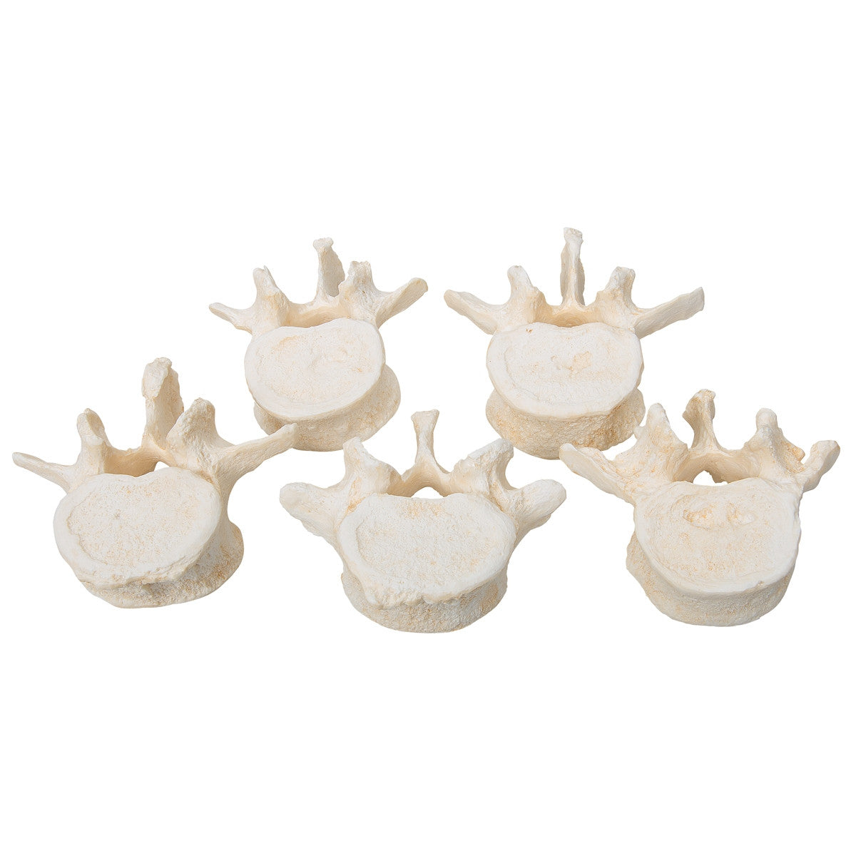 BONElike Lumbar Vertebrae Model Set (5 part)