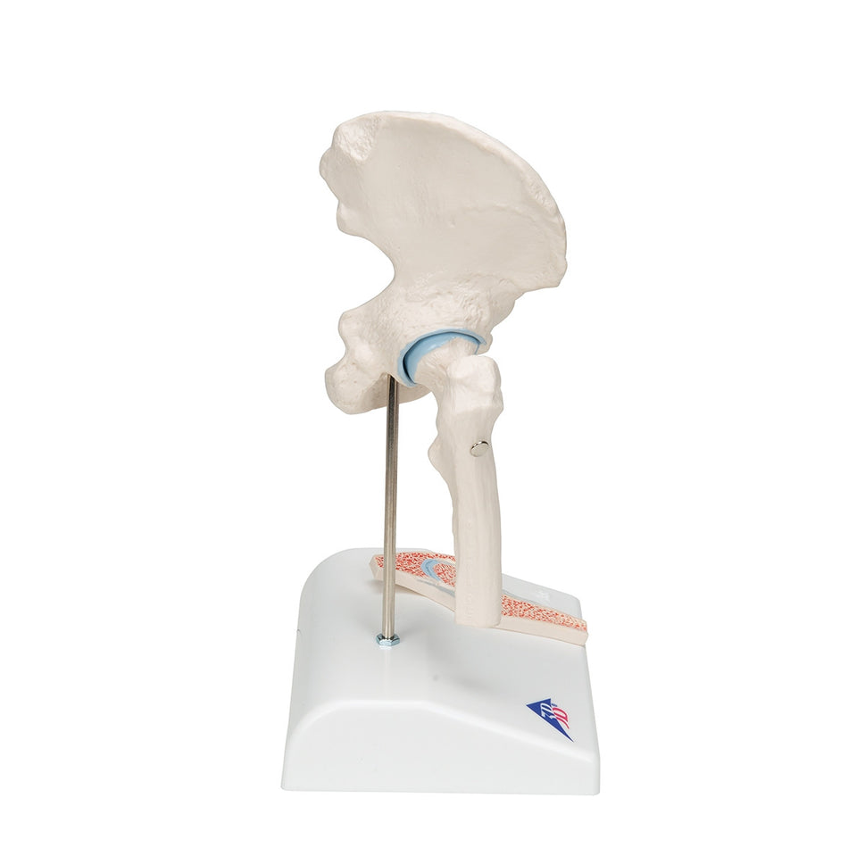 Mini Hip Joint Model with Cross-Section