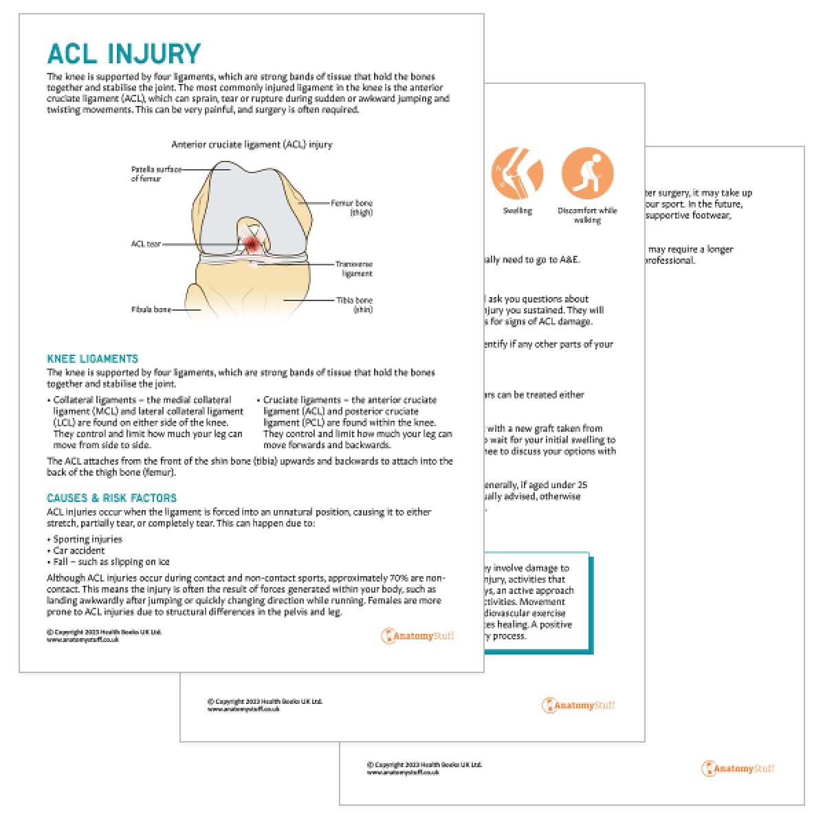 ACL Injury Patient Education Handout (Printable PDF)