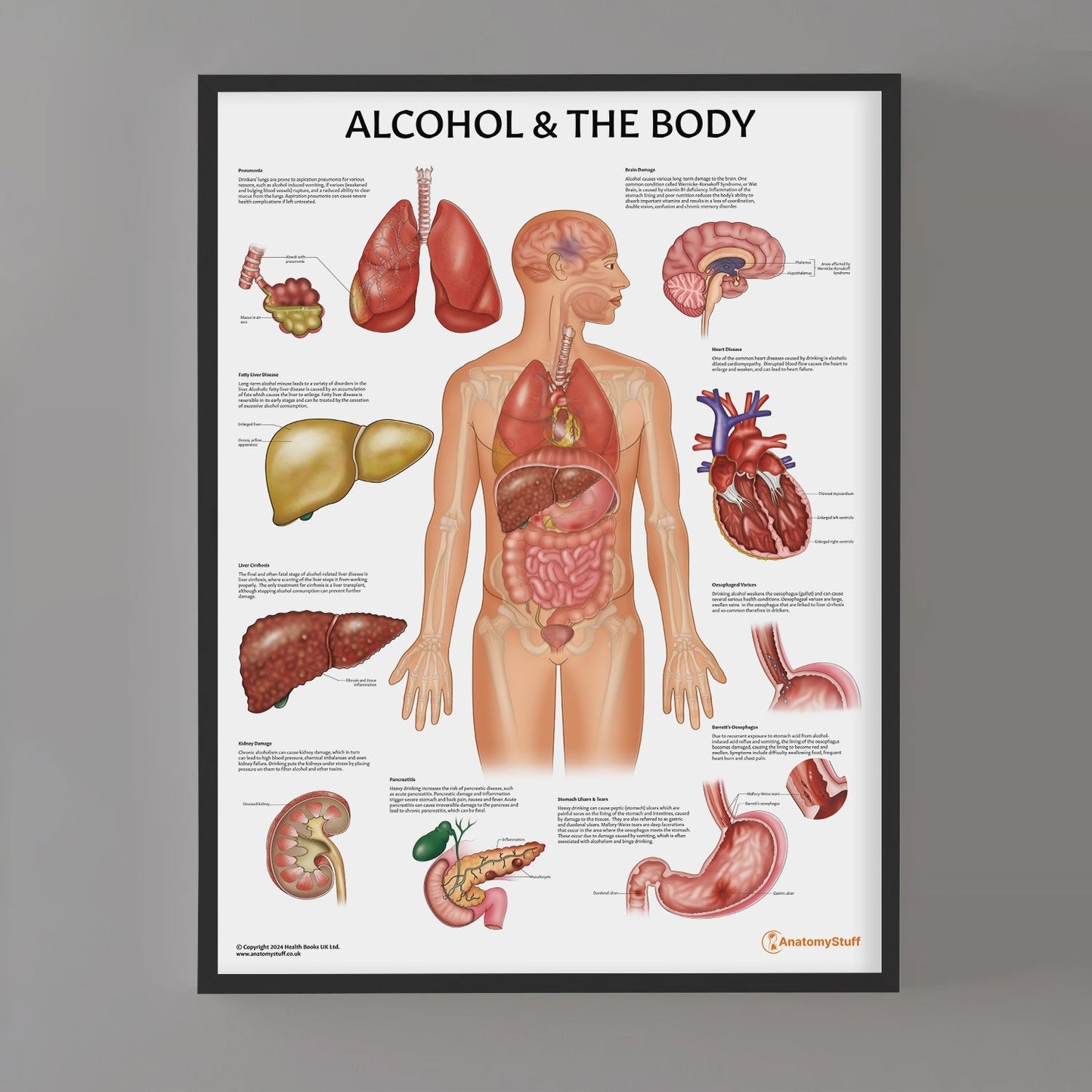 Alcohol and The Body Chart / Poster - Part of Collection