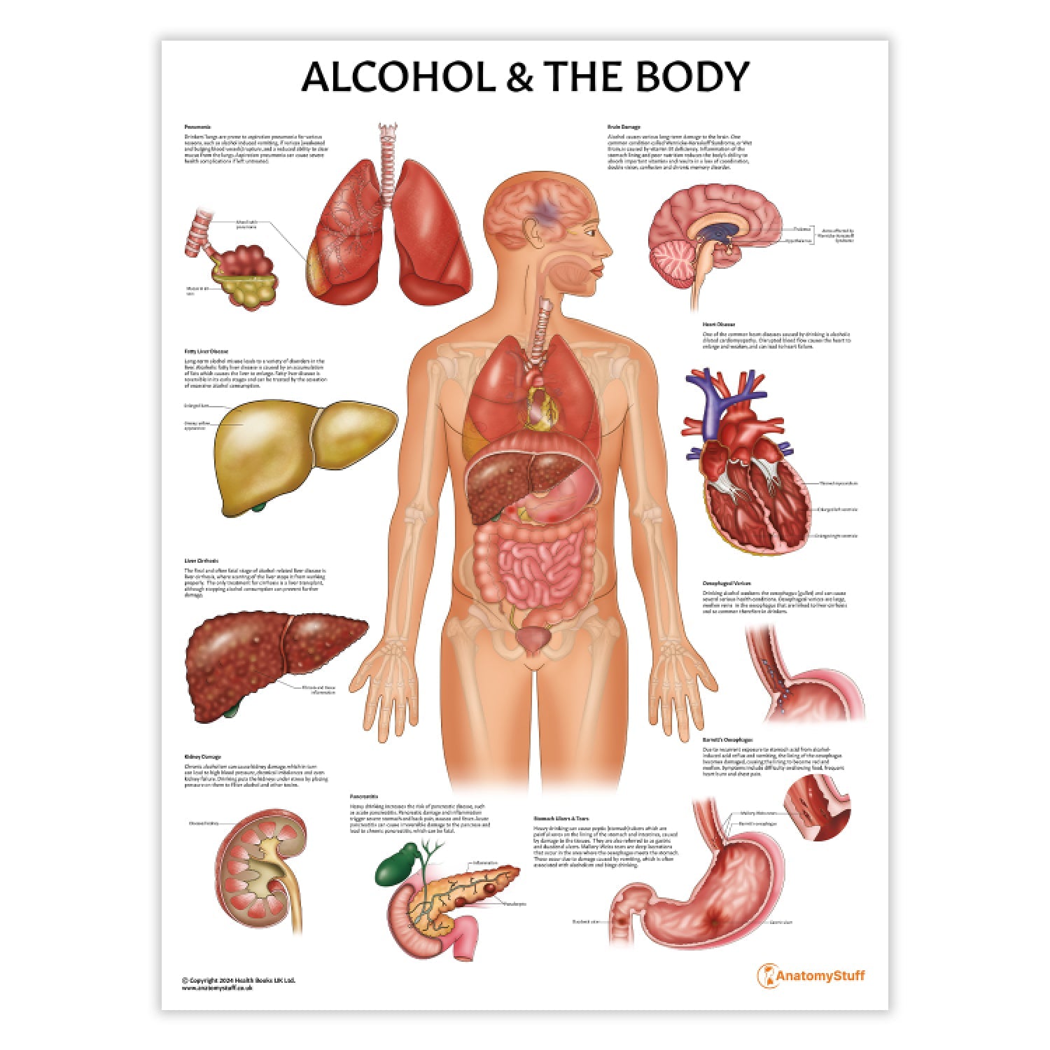 Alcohol and The Body Chart / Poster