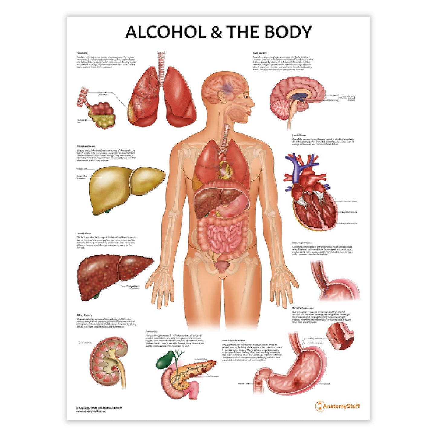 Alcohol and The Body Chart / Poster - Part of Collection