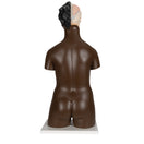 Switch Dark Skin Tone Dual-Sex Torso Model - Posterior View 1000202 2 image