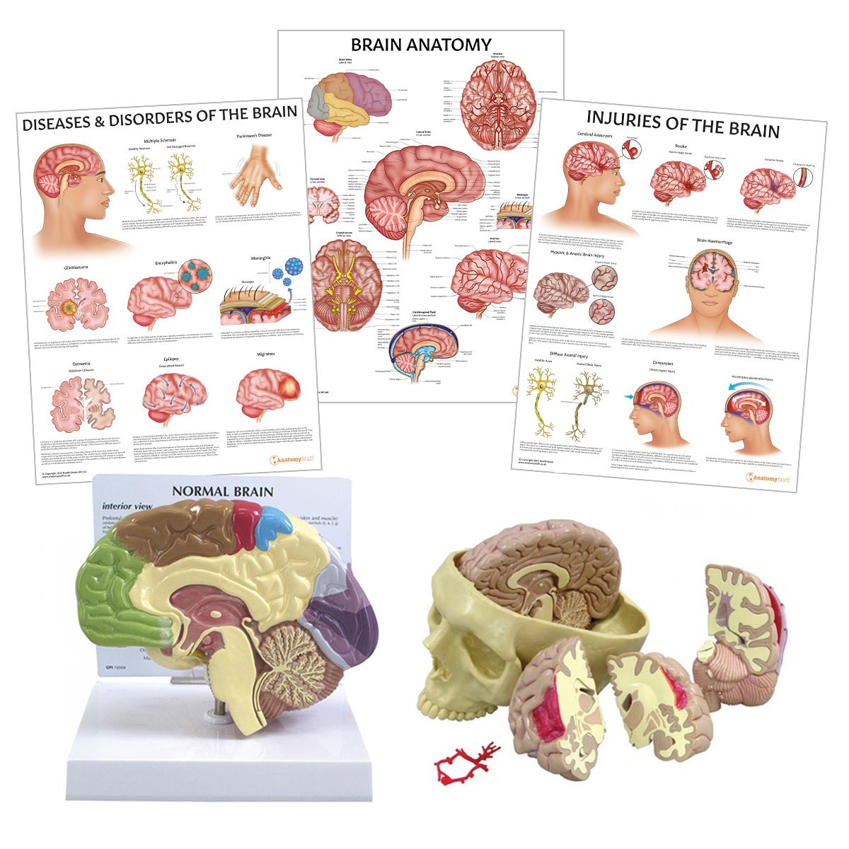 Image Of Brain Anatomy New Study Looks To Identify Regions In The