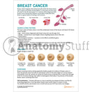 Switch Breast Cancer Handout for Patients Front Page 2 image