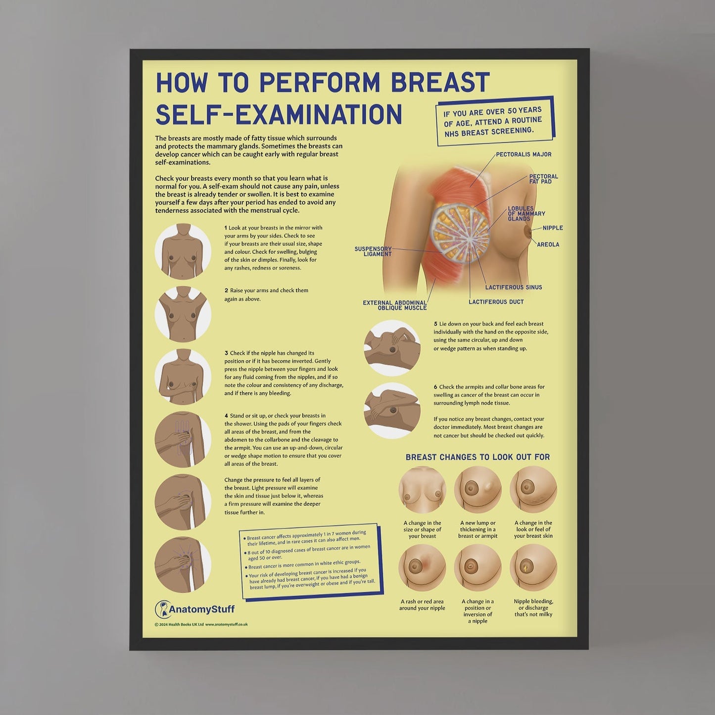 How to Perform Breast Self Examination (BSE) Chart / Poster - Part of Collection