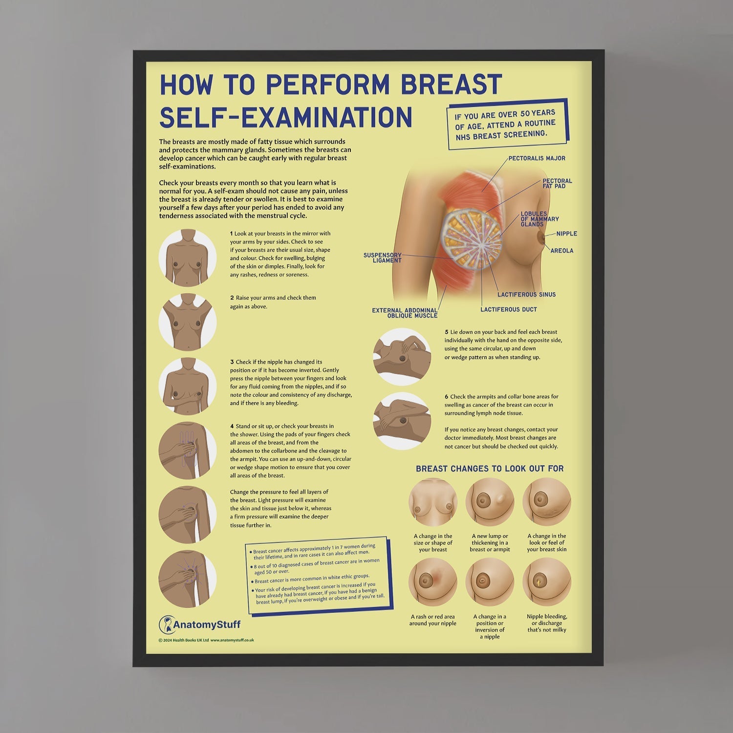 How to Perform Breast Self Examination (BSE) Chart / Poster - Part of Collection
