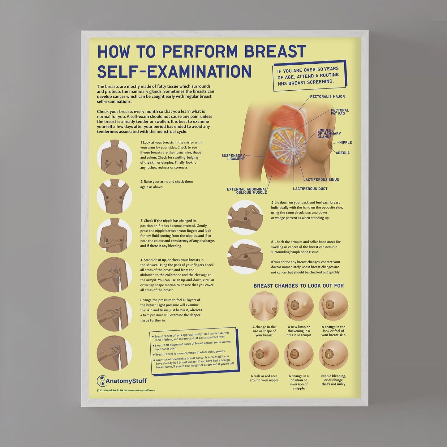 How to Perform Breast Self Examination (BSE) Chart / Poster - Part of Collection