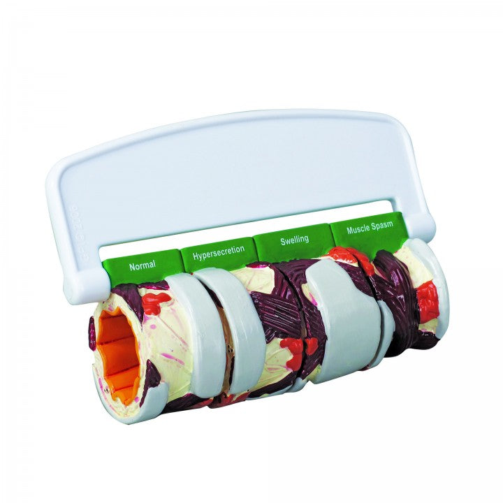 Bronchus Model 3120 labels