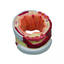 Switch Bronchus Model 3120 slice 3 image