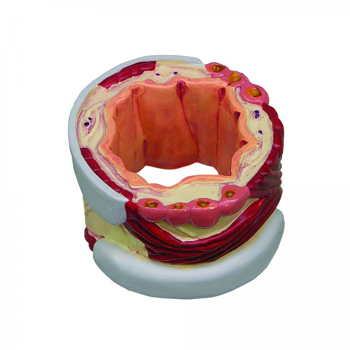 Bronchus Model (4 stages)
